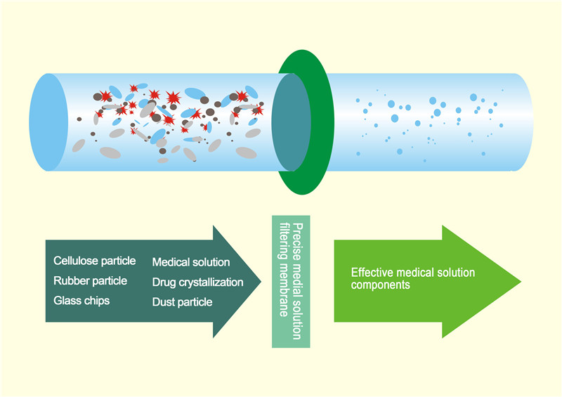 TPE precise filter infusion setJiangxi Sanxin Medical Technology Co., Ltd